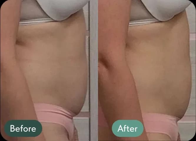 “I didn’t realize how much my posture affected everything — my well-being, my confidence, even how I breathe”. The stomach has become flatter and less protruded because of the improved and more aligned posture. Improved internal organs positioning eliminates bloated look as well and turn pelvic floor muscles. More upright position of the body which allows deeper diaphragmatic breathing and enhance digestion and overall organ function