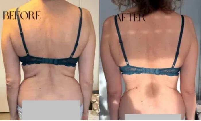 Age: 45 years · Using the method for: 1 week. The waistline looks more defined and elongated. The back appears straighter and more toned. Shoulders have opened up, improving posture. Muscle definition along the spine is more visible. The overall silhouette looks slimmer, lighter, and more balanced.