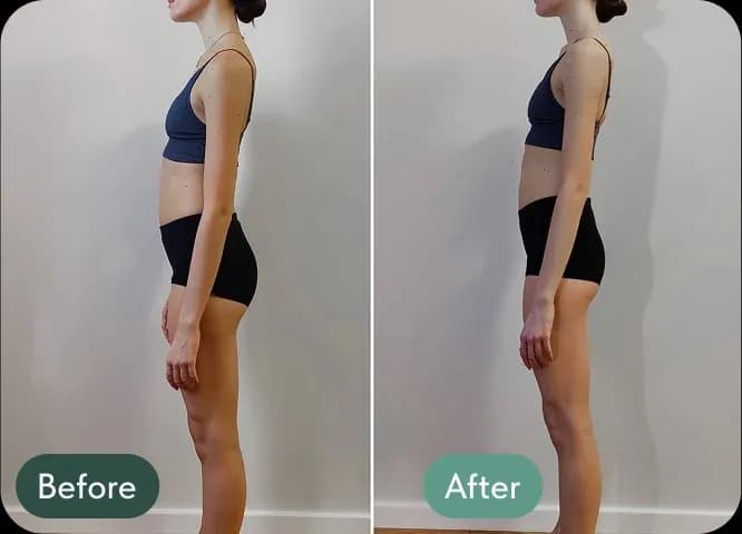 “For the first time in years, I feel like I’m standing tall”. Neutral position of the pelvis, this contributes to the better functioning of internal organs, improves blood circulation in the pelvic region and reduces the risk of stagnation of lymph and blood. The pelvis is stabilized, which means that the pelvic floor muscles, deep abdominal muscles and lower back work more efficiently, supporting the internal organs in the correct position. Tightened glutes and deep core muscles which lead to better body balance