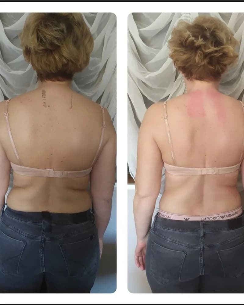 Participant before and after 3