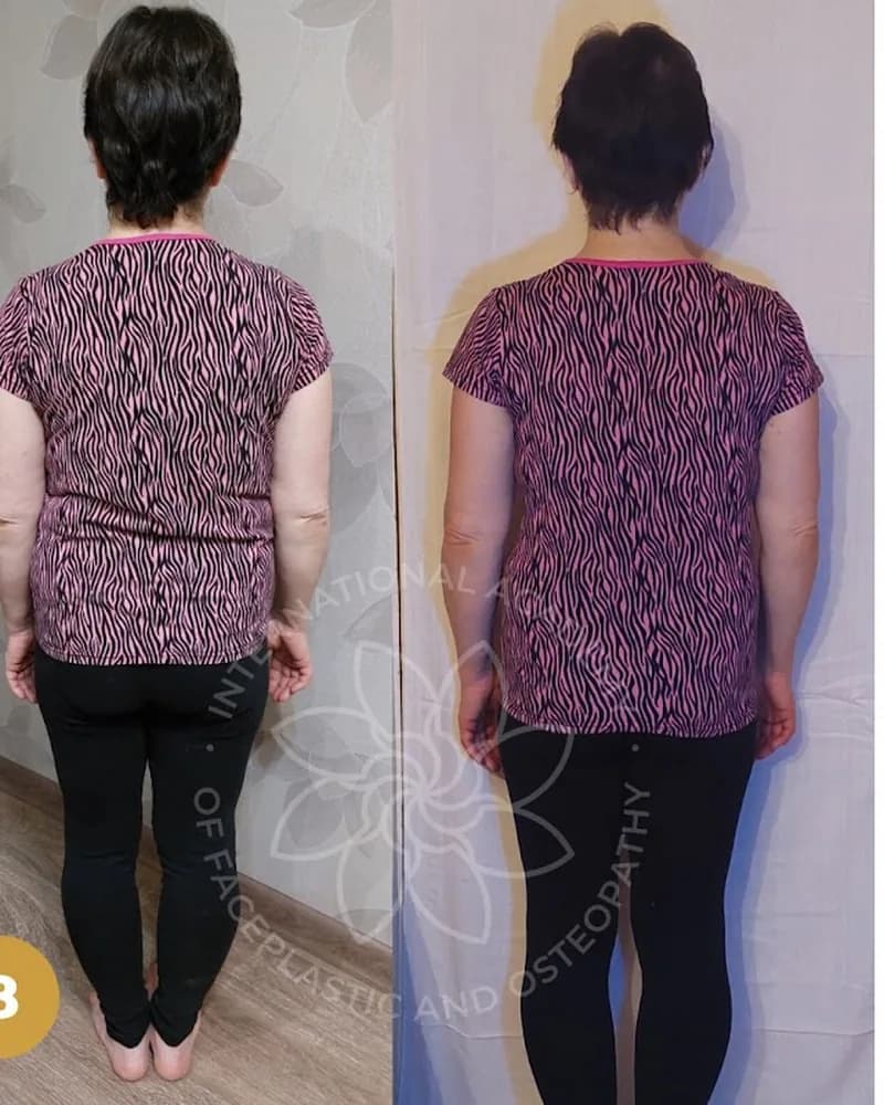 Participant before and after 6