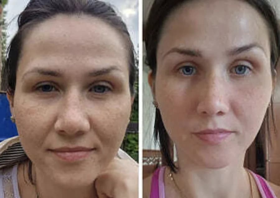 Lighter upper eyelid and open gaze