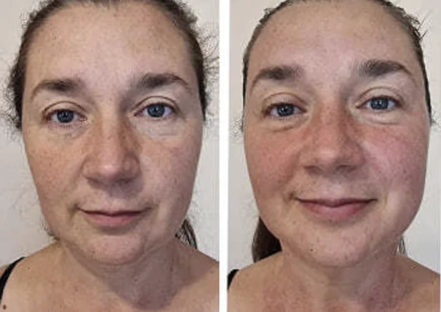 Fresher complexion, less morning puffiness