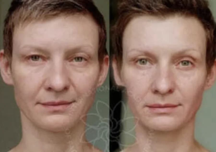 Lighter face and neck