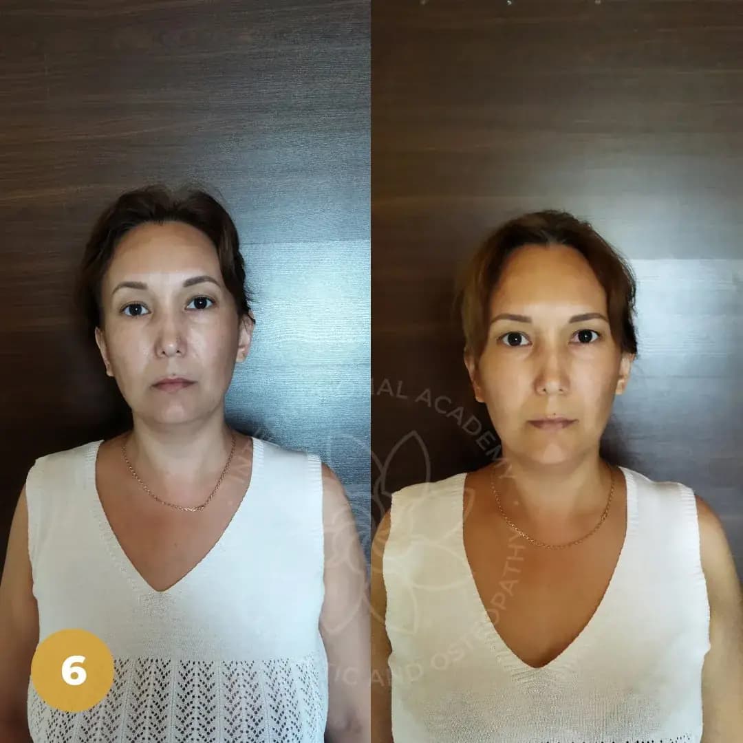 Before and after result 7