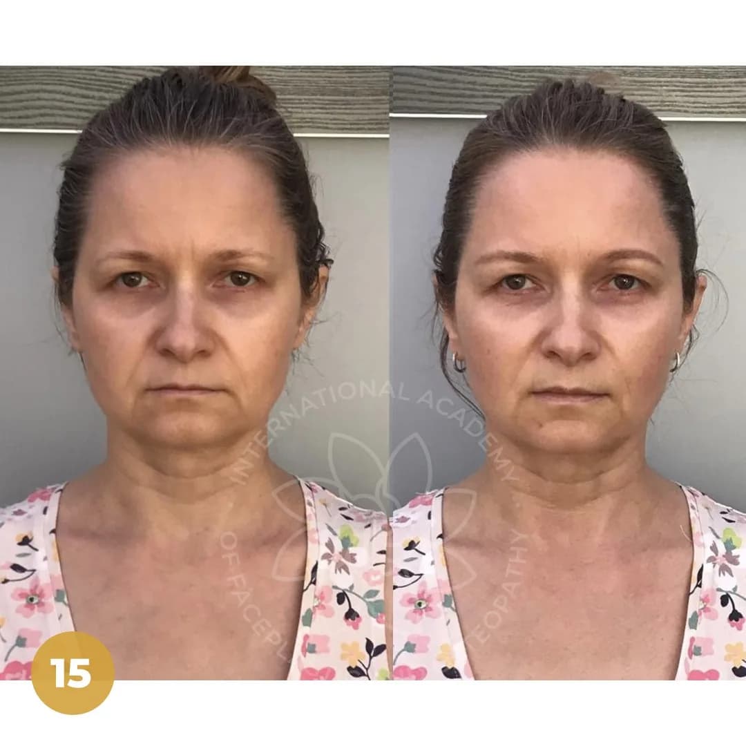 Before and after result 8
