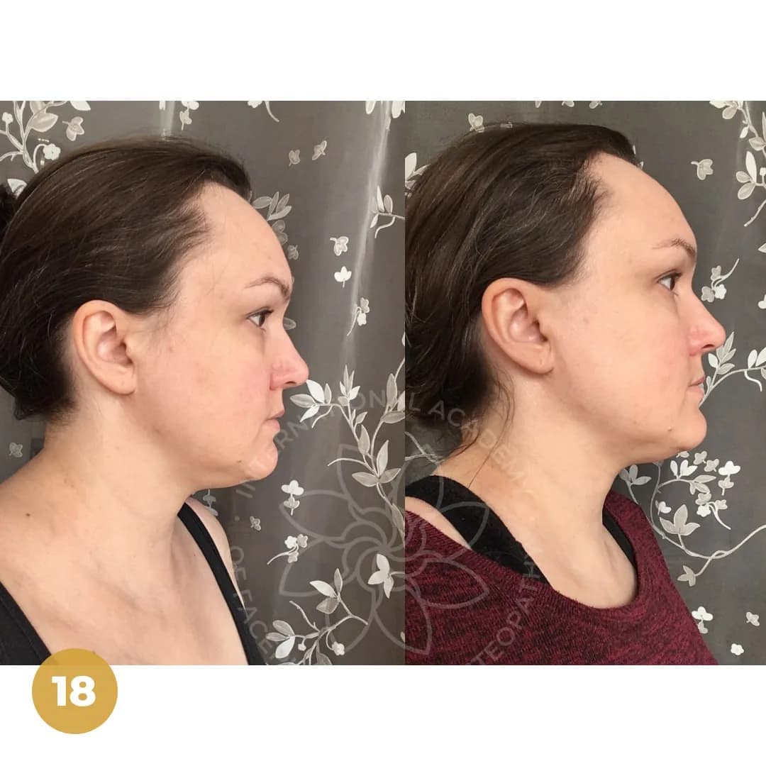 Before and after result 9