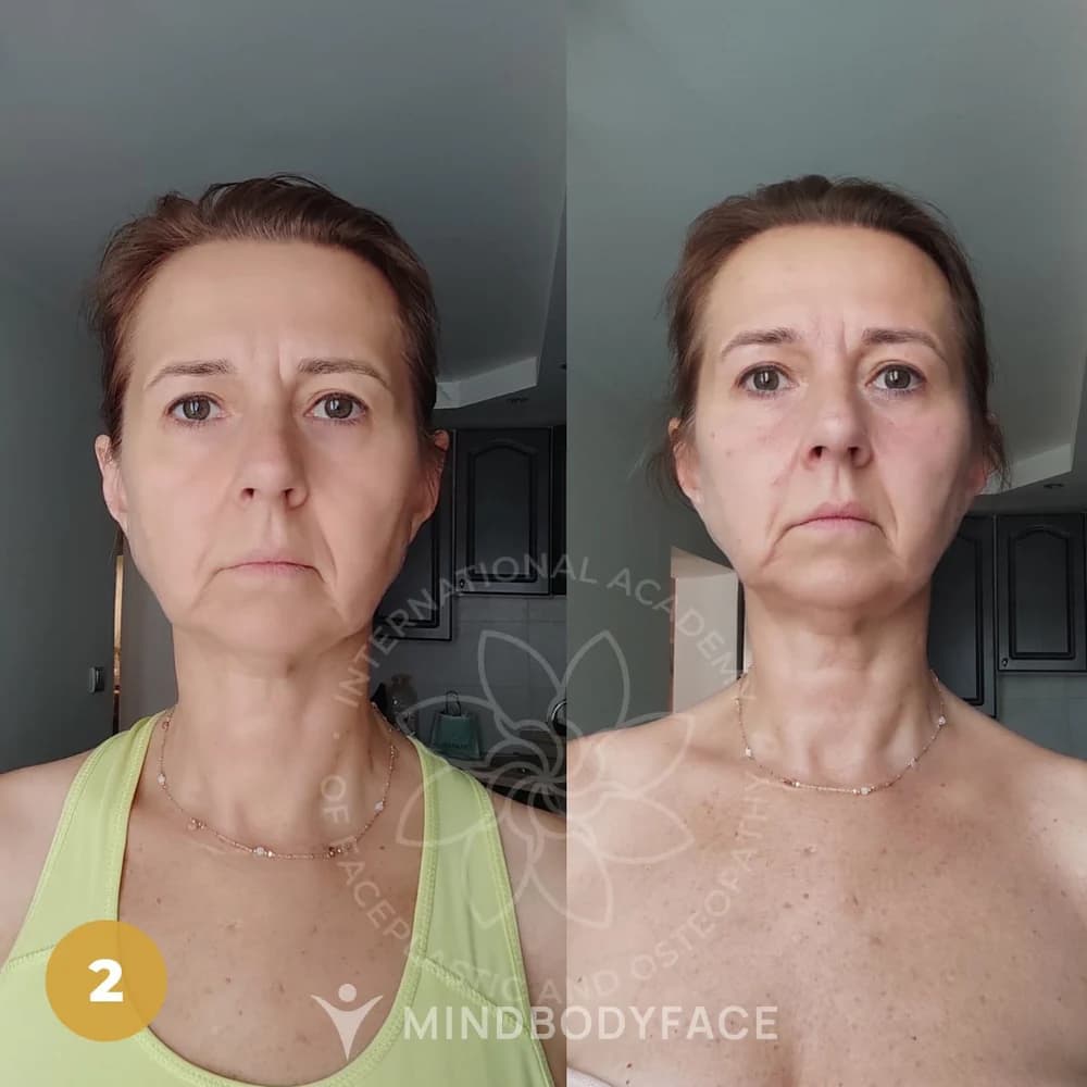 Before and after the Lymphatic Detox program