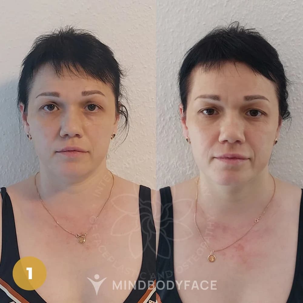 Before and after the Lymphatic Detox program