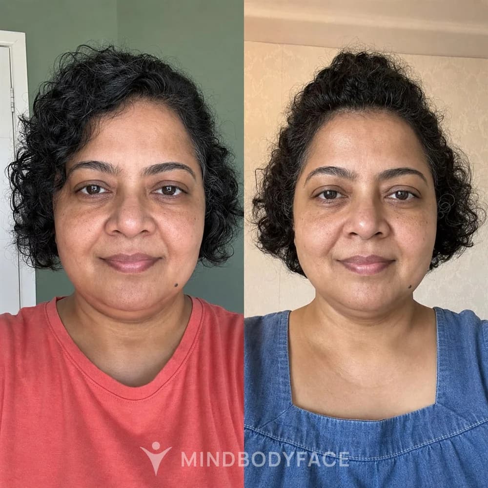 Before and after the Lymphatic Detox program