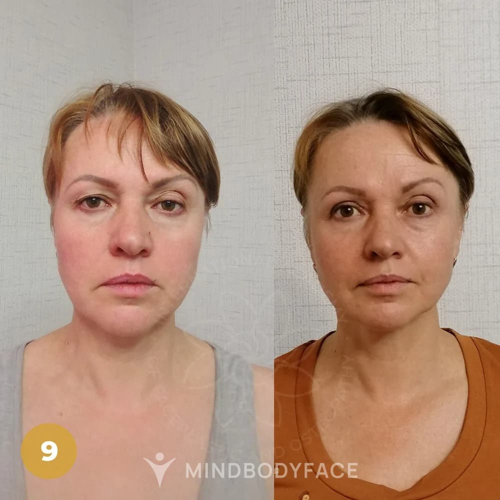 Before and after the Lymphatic Detox program
