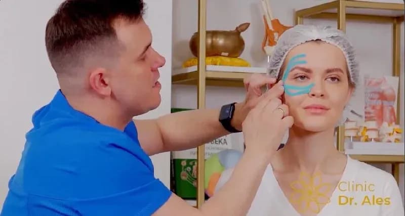 A frame from a real lesson, a taping pattern being demonstrated on a model