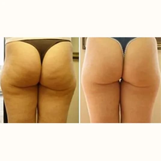 Member before and after