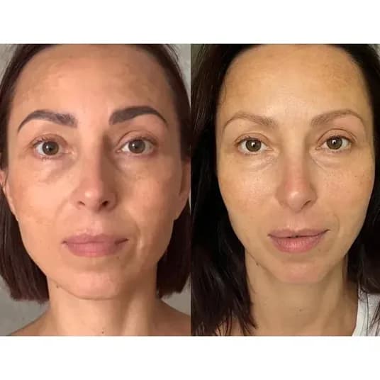 Member before and after