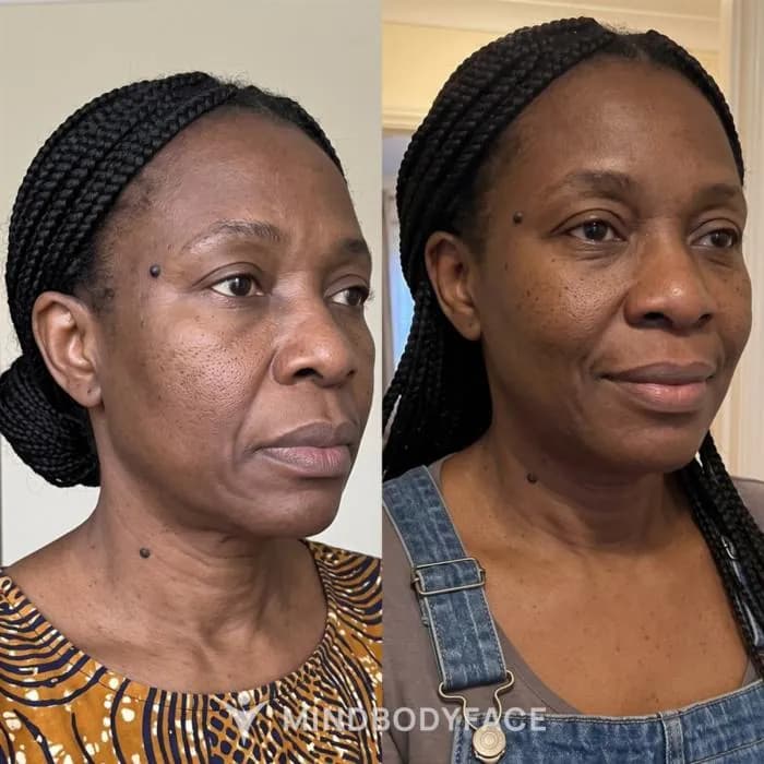 Before and after case 3