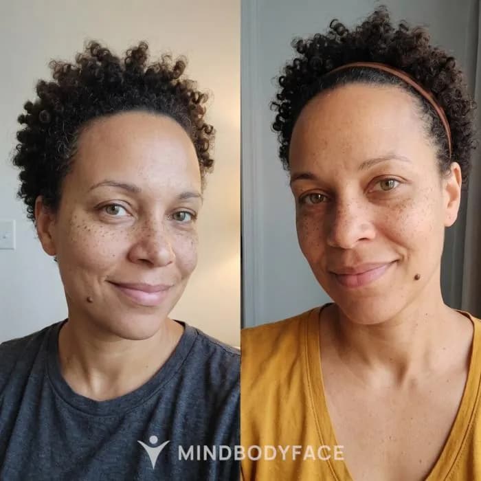 Before and after case 8