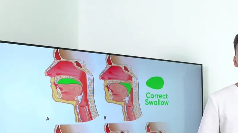 Swallowing Pattern