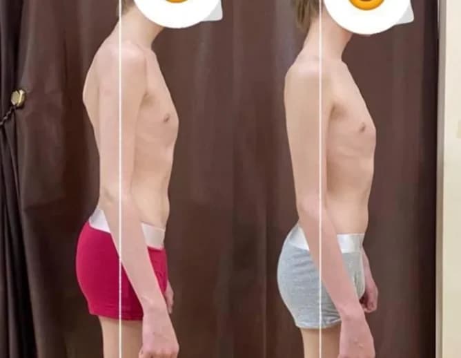the spine has straightened noticeably. the shoulders are more open and aligned. the chest is lifted and the head is held higher. the posture looks confident and stable. the overall silhouette is taller, stronger, and more balanced