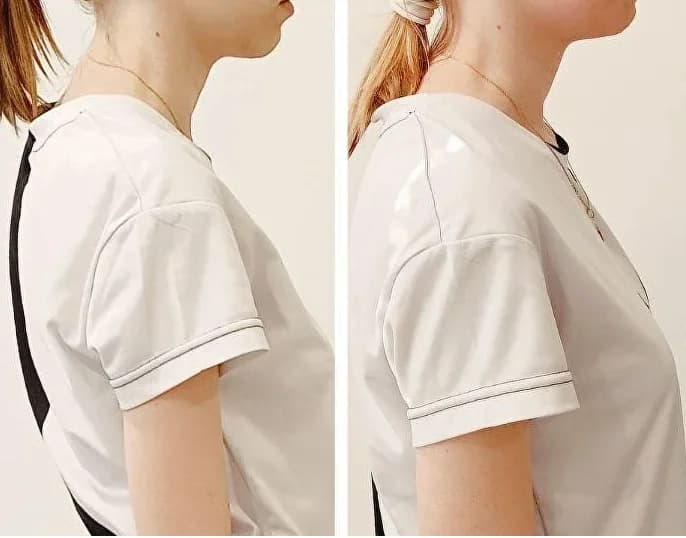 the head and neck have straightened into a more aligned posture. the shoulders appear more relaxed and open. the back has visibly lengthened and lifted. the profile looks more confident and graceful. the entire silhouette feels lighter and more balanced
