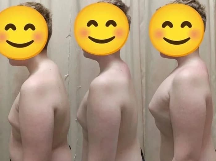 the back began to straighten. the shoulders opened up and the chest lifted. the spine appears more aligned and supported. the posture has become noticeably more upright and confident. the whole upper body looks stronger and more balanced