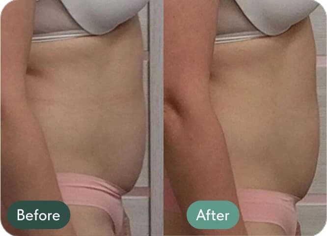 Participant result 2: before and after