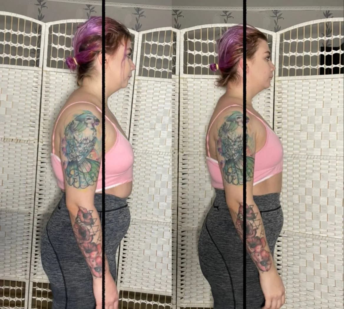 the head sits more naturally over the shoulders, with less forward-head posture. the upper back appears straighter and less rounded. the shoulders look less rolled forward and more open. the torso appears more upright and vertically aligned. the overall posture looks taller and more balanced