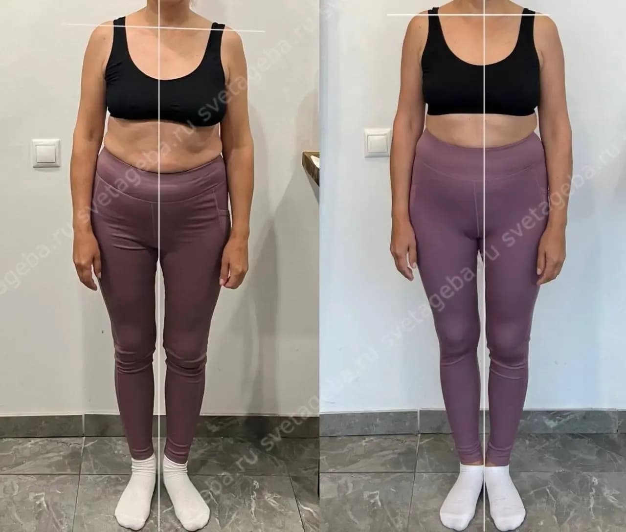 “I didn’t realize how much my posture affected everything — my well-being, my confidence, even how I breathe”. The stomach has become flatter and less protruded because of the improved and more aligned posture. Improved internal organs positioning eliminates bloated look as well and turn pelvic floor muscles. More upright position of the body which allows deeper diaphragmatic breathing and enhance digestion and overall organ function