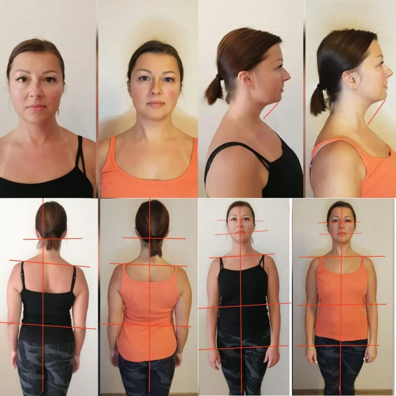 Age: 32 years · Using the method for: 1 week. The shoulders have become more level and relaxed. The spine looks more aligned and centered. Tension in the upper back has visibly reduced. The posture appears straighter and more balanced. The overall silhouette feels lighter and more harmonious.