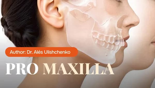 PRO Maxilla