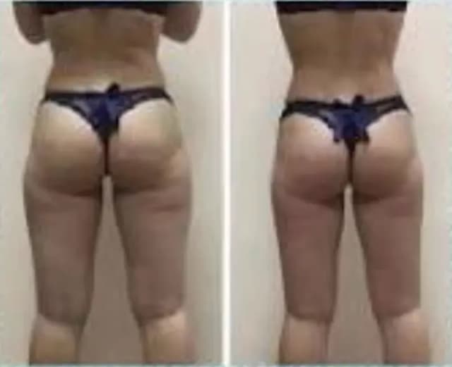 Before and after result 2