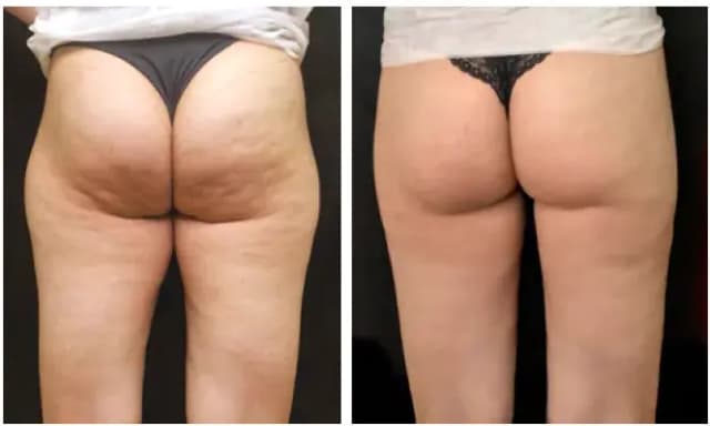Before and after result 8