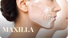 Maxilla
