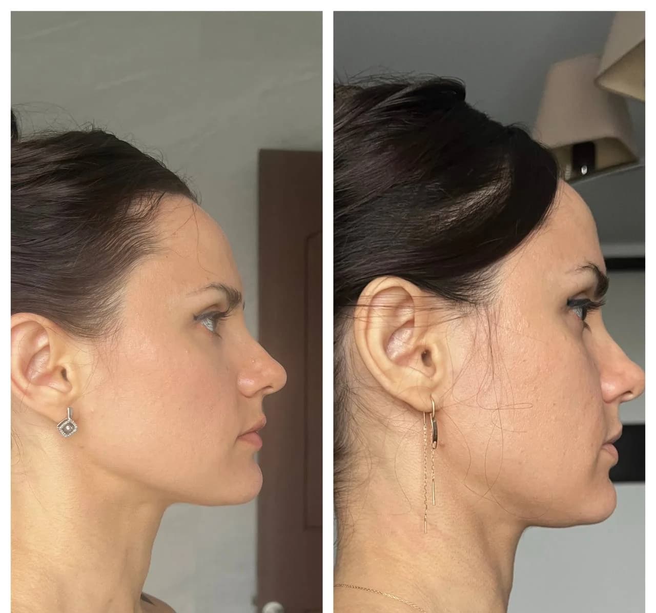 Diane, 49 years old