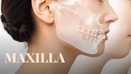Maxilla