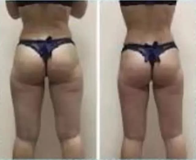 Before and after result 2