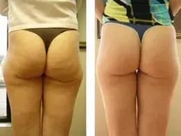 Before and after result 6
