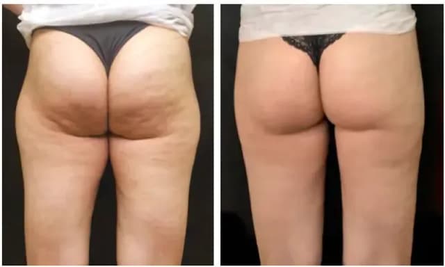Before and after result 8