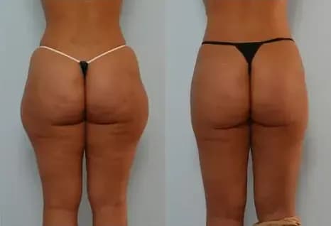 Before and after result 7