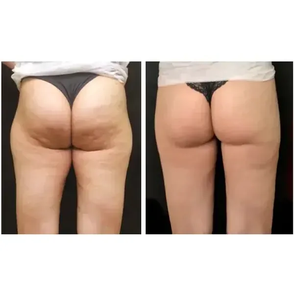 Member before and after