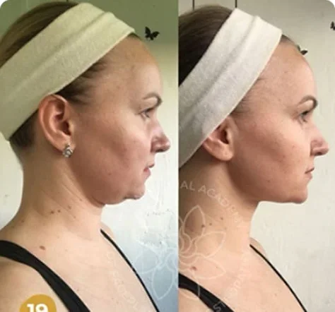 YOUNG AND BEAUTIFUL NECK