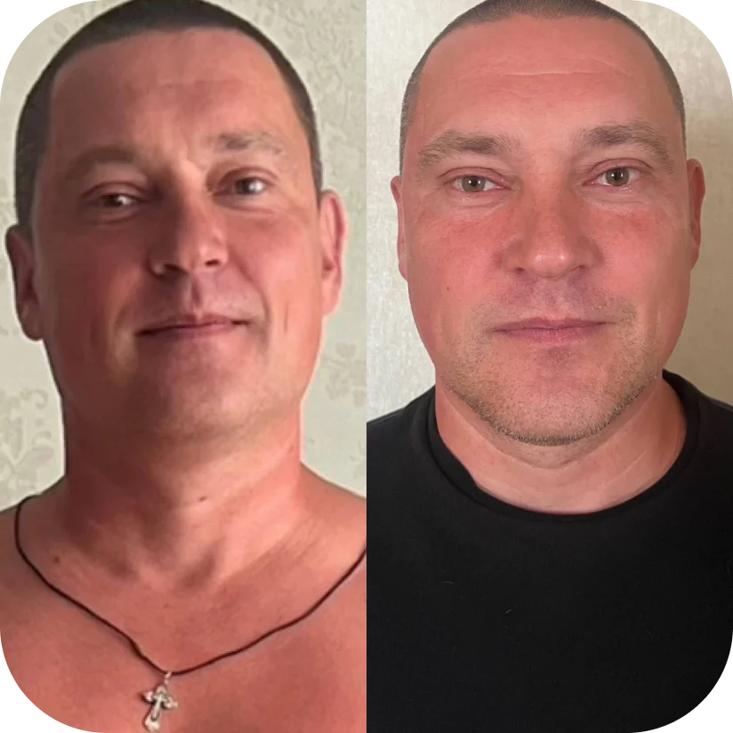 Before and after — Alex, 44