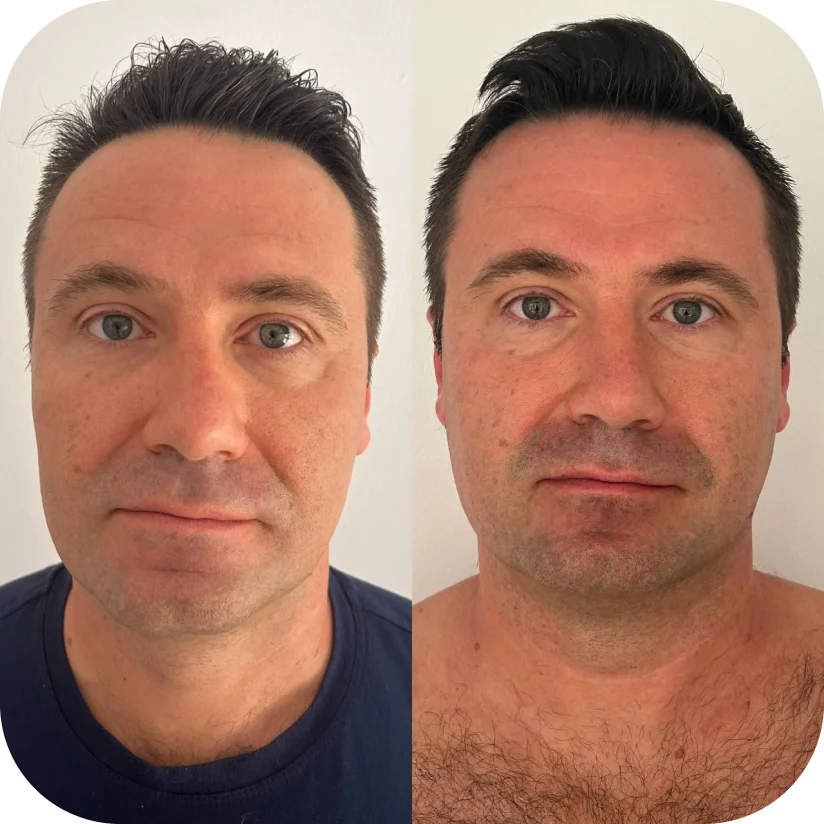 Before and after — Andrew, 42
