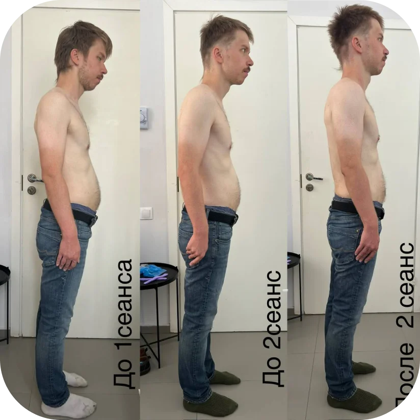 Before and after — Daniel, 28