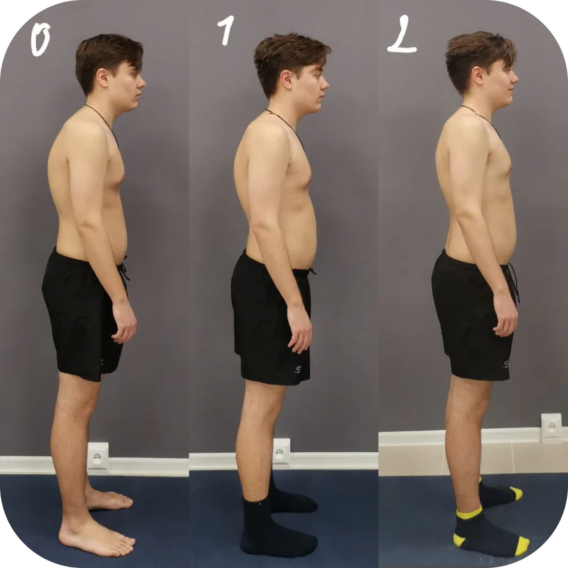 Before and after — Mark, 29