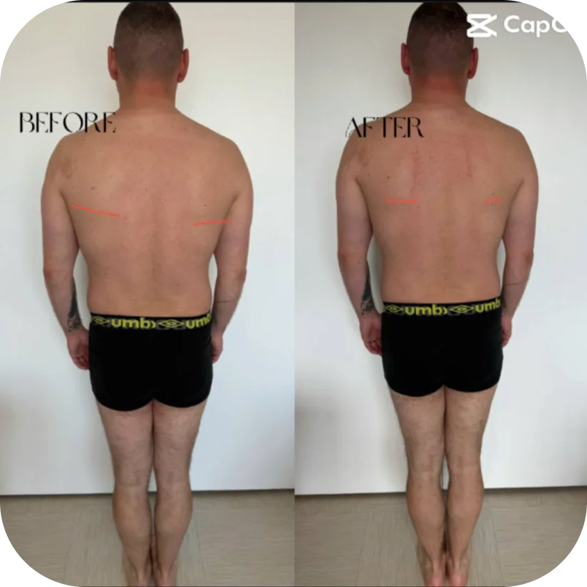 Before and after — Mark, 53