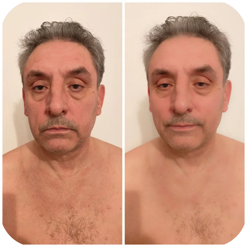 Before and after — Nick, 59