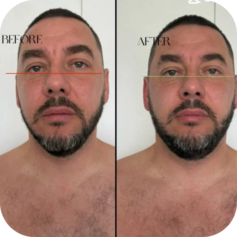 Before and after — Paul, 36