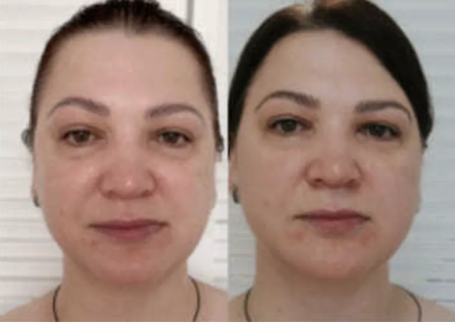 Before and after: result of a MindBodyFace student