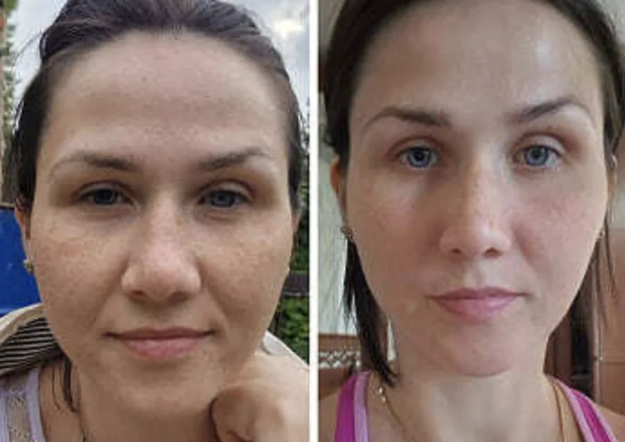 Before and after: result of a MindBodyFace student
