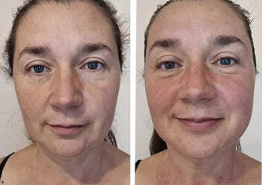 Before and after: result of a MindBodyFace student